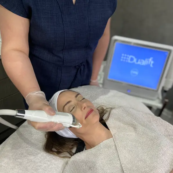 HIFU 5D Microneedling mit Radiofrequenz Behandlung gegen Narben im Gesicht