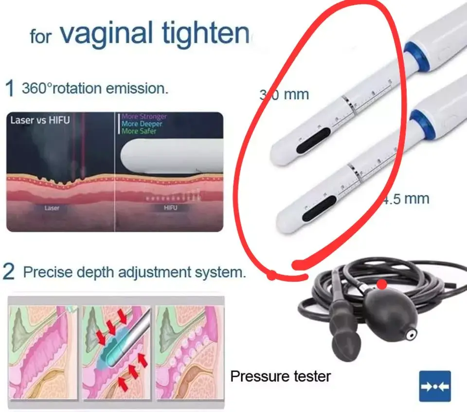 HIFU-System zur vaginalen Straffung durch nicht-invasive Ultraschall-Fokussierungstechnik