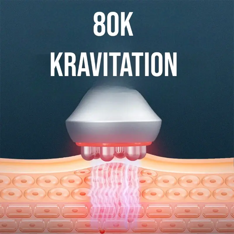 80kkrativation