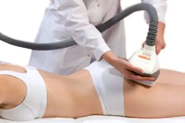cellulite entfernen lassen